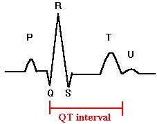 QT interval