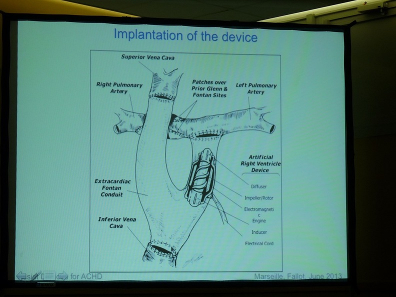2013_juin_11_12_congres_fallot_marseille_55.JPG